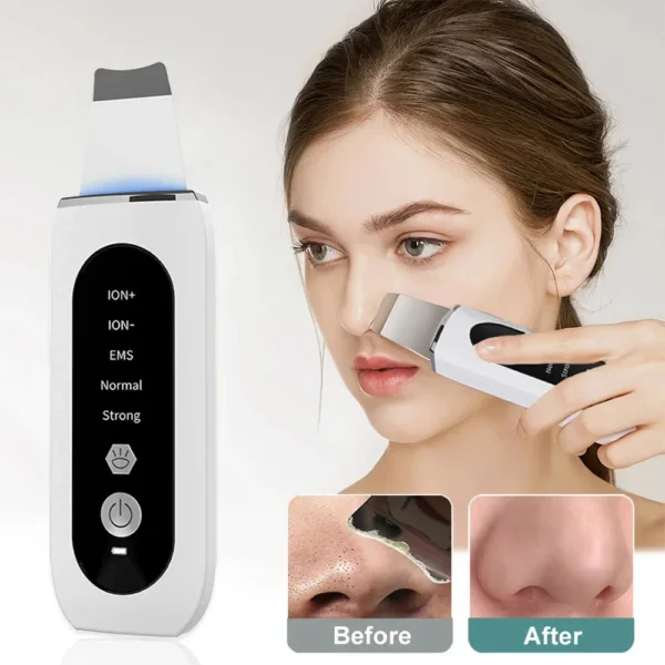 Ultrasonic Skin Scrubber Peeling Blackhead Remover Deep Face Cleaning Ultrasonic Ion Ance Pore Cleaner Facial Machine Device